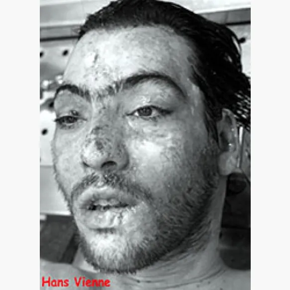 Découverte du corps sans vie de Hans VIENNE